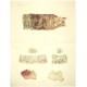 Pirogov - Anatomie Pathologique ou Choléra-Morbus, Atlas, Saint Petersburg, 1849